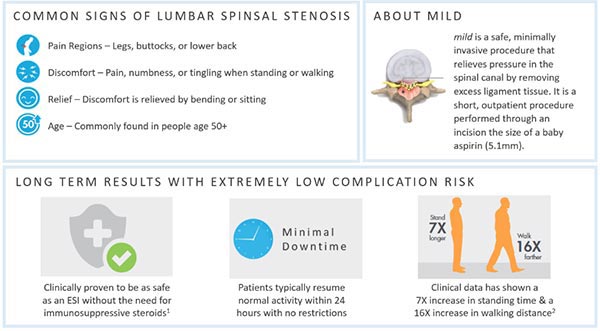 M.I.L.D. procedure for back pain in Mesquite, Frisco and Desoto, TX M.I.L.D. procedure for back pain in Mesquite, Frisco and Desoto, TX