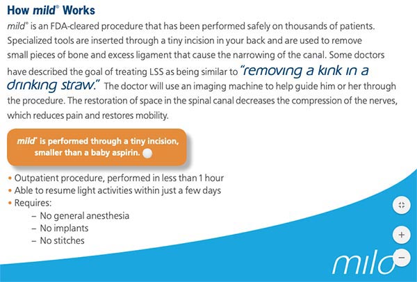 M.I.L.D. procedure for back pain in Mesquite, Frisco and Desoto, TX M.I.L.D. procedure for back pain in Mesquite, Frisco and Desoto, TX