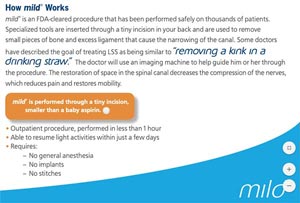 M.I.L.D. procedure for back pain in Mesquite, Frisco and Desoto, TX M.I.L.D. procedure for back pain in Mesquite, Frisco and Desoto, TX